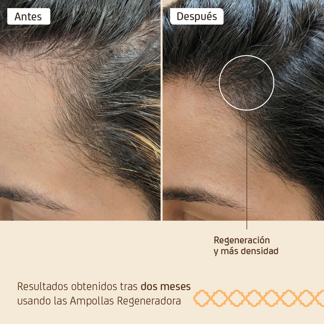 Ampolla Regenerador Capilar - Imagen 3